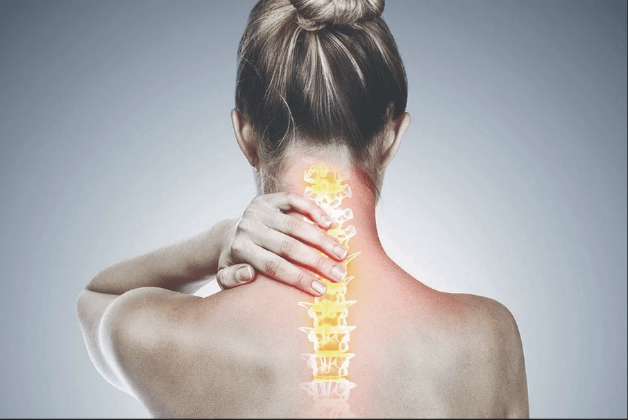 Osteochondroza szyjka macicy