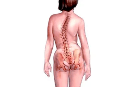 Przyczyny rozwoju osteochondrozy szyjki macicy